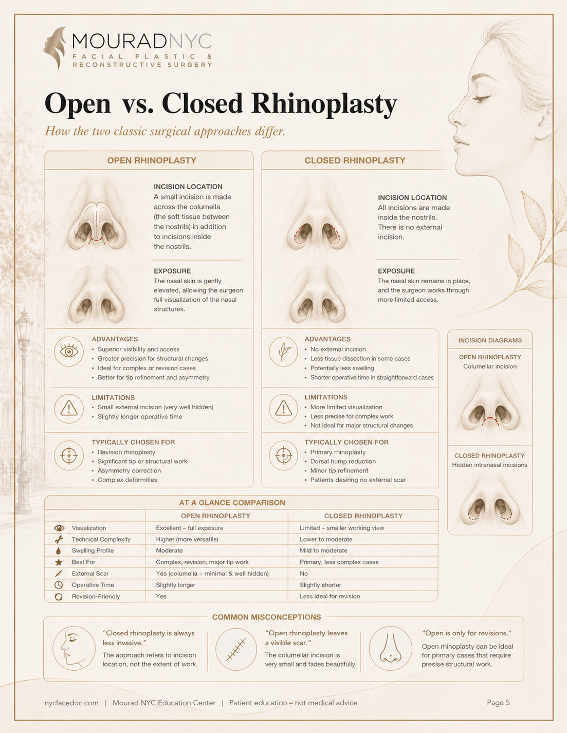 Rhinoplasty Guide — page 5: Open vs. Closed Rhinoplasty