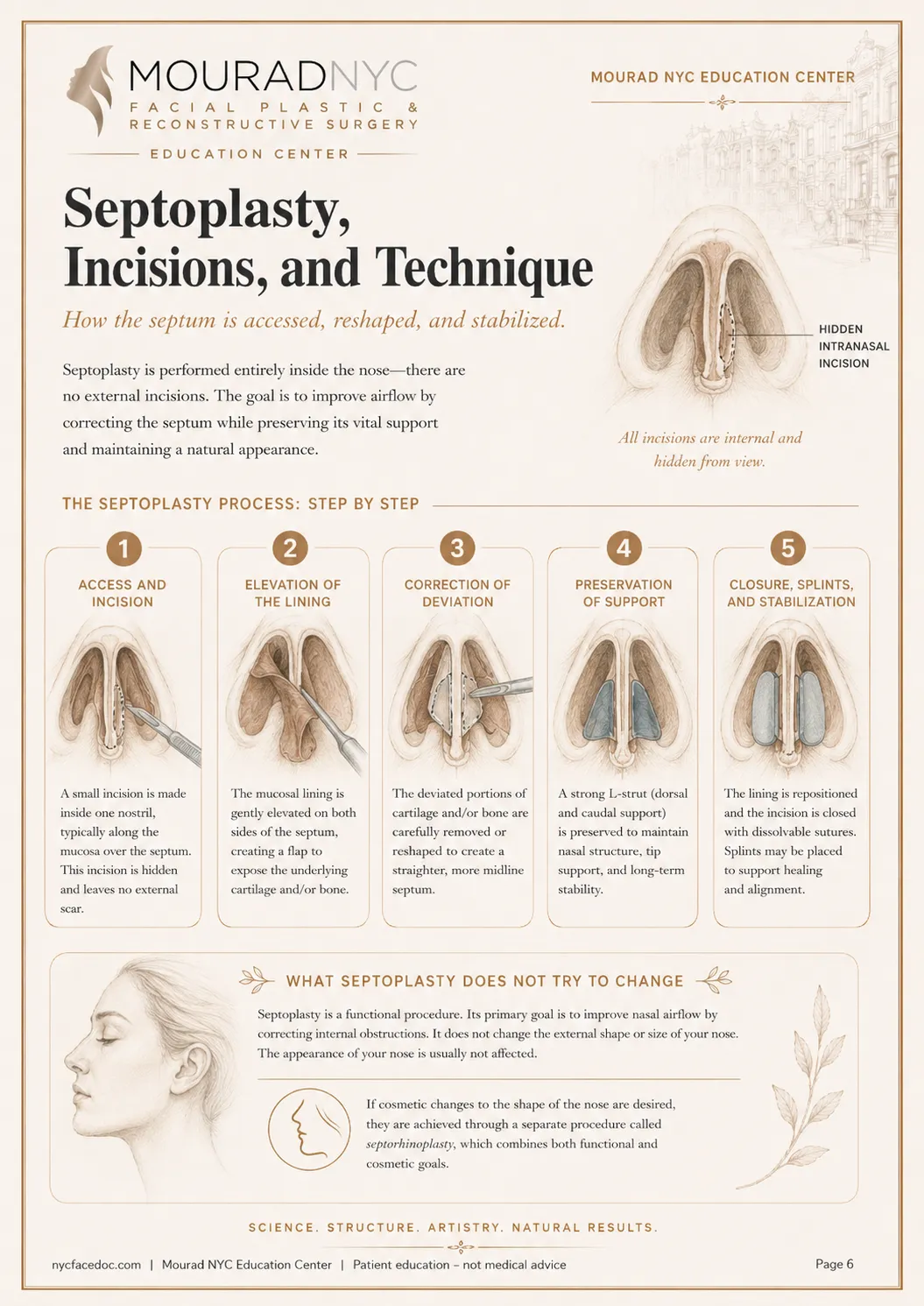 Septoplasty Guide — page 6: Septoplasty, Incisions, and Technique
