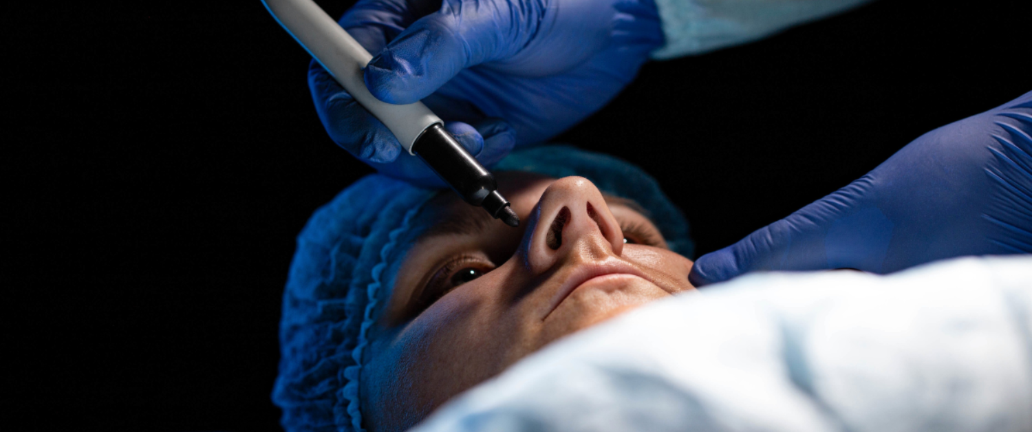 septoplasty nyc