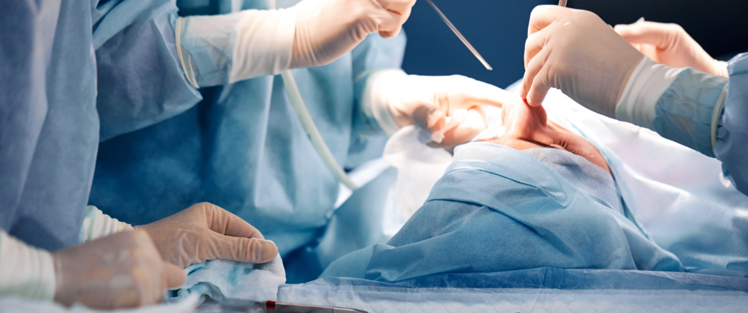 Revision Rhinoplasty NYC