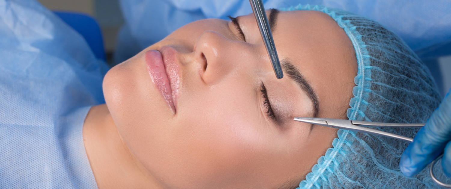 Blepharoplasty NYC