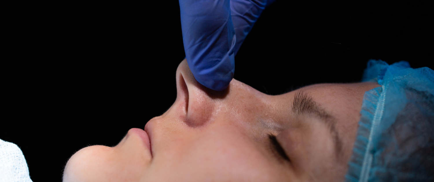 Nasal Turbinate Hypertrophy