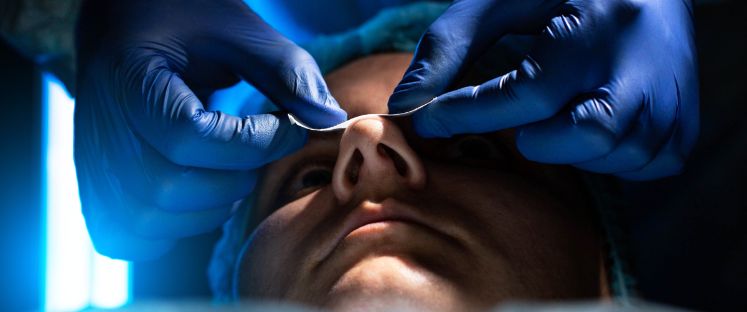 Septal Perforation Repair